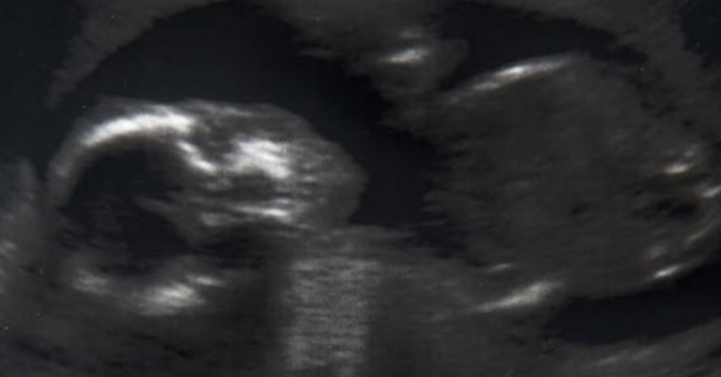 Mom Loses Unborn Baby But Then Discovers She Had A Secret