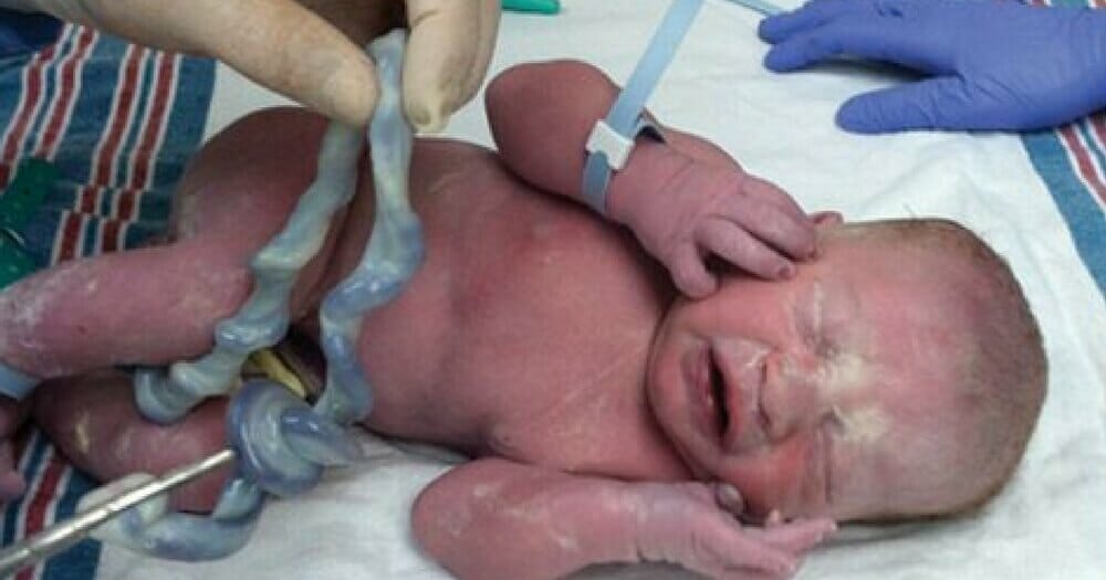 Doctor Takes One Look At The Newborn S Umbilical Cord And Rushes To   2 49 