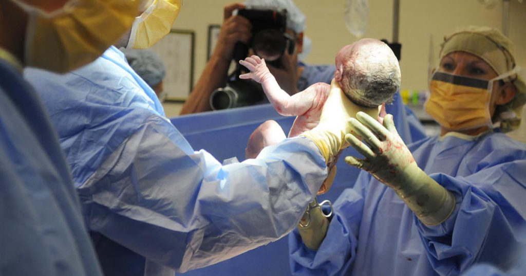 Doctor Takes One Look At The Newborn’s Umbilical Cord And Rushes To ...