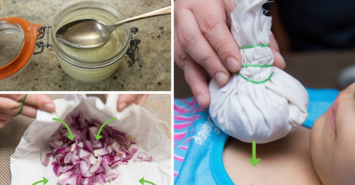 12 surprising ways onions are used as a natural remedy for many