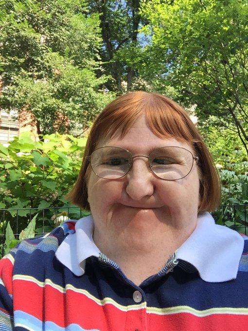 Disabled Woman Told She Is ‘too Ugly To Post Photos Responds Back 