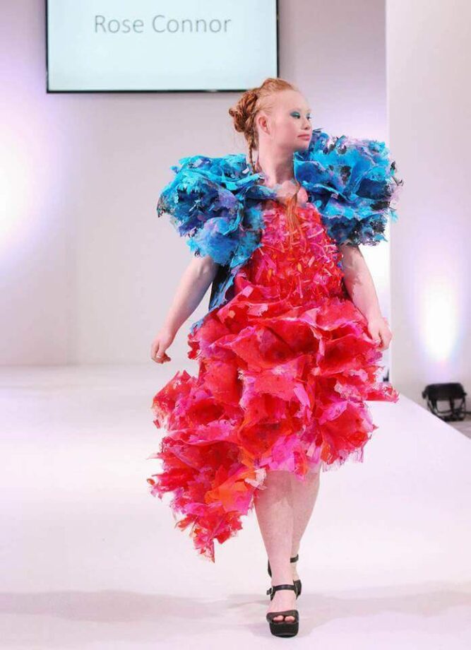 Girl With Down Syndrome Follows Her Dream Of Being A Model After Losing ...